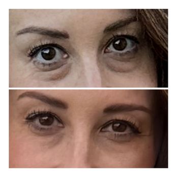 Ali Cat's Spa - Under eye treatment - Skin Care Near Me - Mesa, Arizona Ali Cat's Spa - Under eye treatment - Skin Care Near Me - Mesa, Arizona