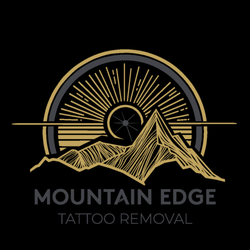 Mountain Edge Tattoo Removal