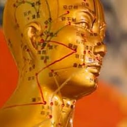 Kim Keene, DC - Acupuncture can help many conditions