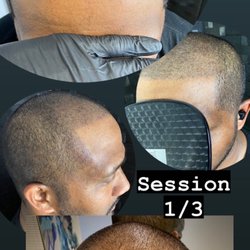Universal Scalps - Session one of three total for density