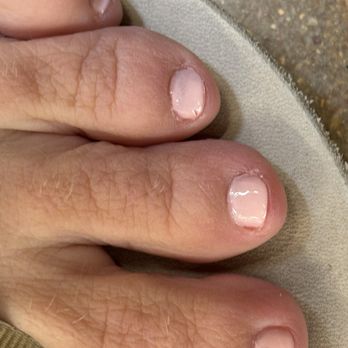 Nail Spa - Poor pedicure - Nail Salons Near Me - Fairview Heights, Illinois Nail Spa - Poor pedicure - Nail Salons Near Me - Fairview Heights, Illinois