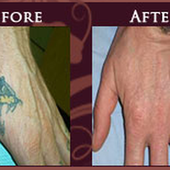 Elliot Heller, MD - Cosmetic Surgeons Near Me - New York, New York