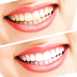 Tooth Care Centre