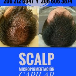 Academy and Clinic Dominick - SCALP MICROPIGMENTACIÓN CAPILAR