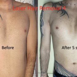 Baliga Ayurveda & Laser Skin Clinic - Men's Laser Hair Removal, London, UK