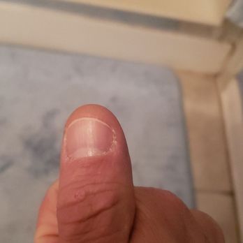 TJ Nails - Horrible manicure done 6 days ago!!??? - Nail Salons Near Me - Colorado Springs, Colorado