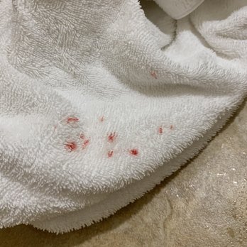 Sheraton Chapel Hill Hotel - Pulled out a clean towel and there were spots of something on it that looked like blood. Really really gross - Hotels Near Me - Chapel Hill, North Carolina Sheraton Chapel Hill Hotel - Pulled out a clean towel and there were spots of something on it that looked like blood. Really really gross - Hotels Near Me - Chapel Hill, North Carolina