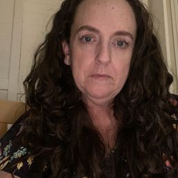 Before lasers, Botox and fillers. 7/24
