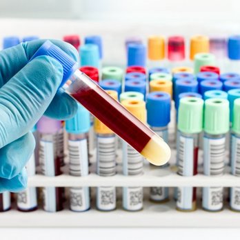 Rapid Labs La - Concierge Medicine Near Me Rapid Labs La - Concierge Medicine Near Me