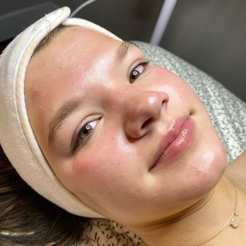 Day By Day Esthetics - Post Facial Glow! - Estheticians Near Me - Monroe, North Carolina