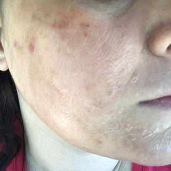 Faces Skincare Centers - Skin Care Near Me - Sacramento, California Faces Skincare Centers - Skin Care Near Me - Sacramento, California