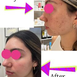 Holistic Skin Center - Face Reality The Clear Skin Method™
