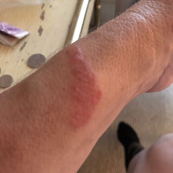 Econo Lodge - This was what happened to me - Hotels Near Me - Ruther Glen, Virginia