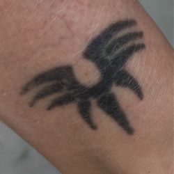 Beauty Doctor - Remove tattoo