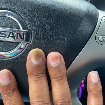Spectrum Nail Spa - Same had the thumb has a fungus , middle finger - Nail Salons Near Me - Charlotte, North Carolina
