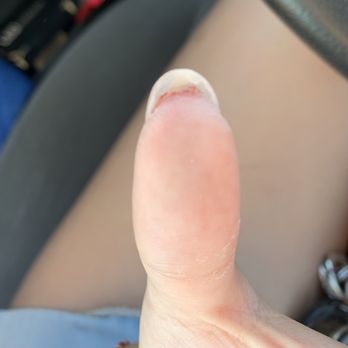 Queen Nails - Cut my skin TWICE under my nail which made me bleed - Nail Salons Near Me - Stockton, California