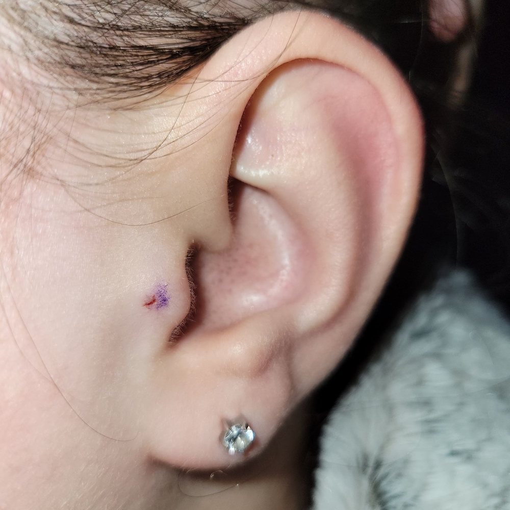 HardRocs Tattoo - After the earring is removed. - Piercing Near Me - Brandon, Mississippi HardRocs Tattoo - After the earring is removed. - Piercing Near Me - Brandon, Mississippi