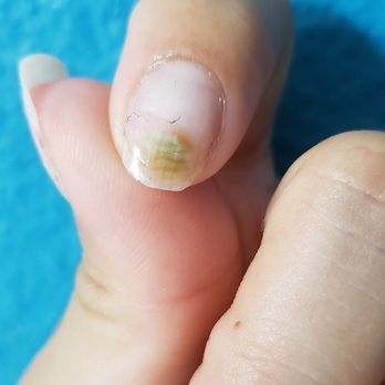 Pampered By Ohana - Fungus unsanitary equipment - Nail Technicians Near Me Pampered By Ohana - Fungus unsanitary equipment - Nail Technicians Near Me