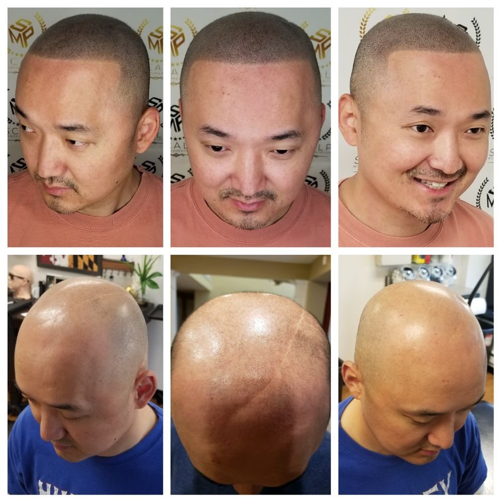 Scalp Micropigmentation Logo