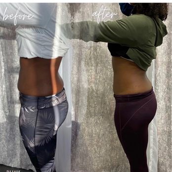Blink Body Sculpting - Body Contouring with Cavitation fat burning Machine - Body Contouring Near Me - Rockville , Maryland Blink Body Sculpting - Body Contouring with Cavitation fat burning Machine - Body Contouring Near Me - Rockville , Maryland