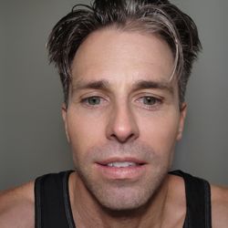 Vafaie Dermatology - 44 Years Young. Kinda greasy sunscreen face, but proud of results.