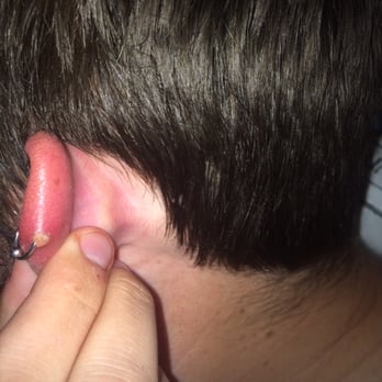 Magic Needle - Allergic reaction to the "Surgical Steel". - Tattoo Near Me - Humble, Texas