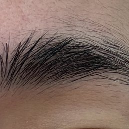 Grown out eyebrow -- patch taken out is in lighter space at the top of my brow just to the center right Grown out eyebrow -- patch taken out is in lighter space at the top of my brow just to the center right