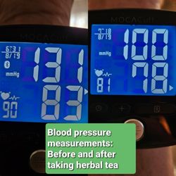 Deng Acupuncture and Herb - Heart rate also better.