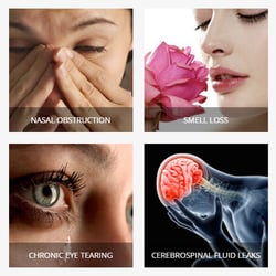 My Houston Surgeons - What we treat @ Houston Advanced Sinus Center