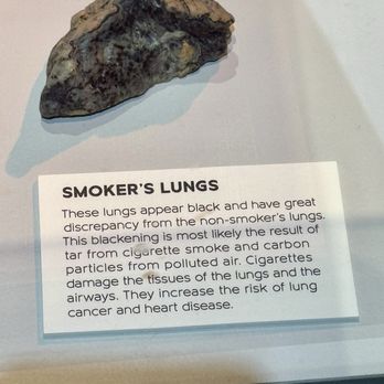 Real Bodies - 04.05.24 Smoker's Lungs - Museums Near Me - Las Vegas, Nevada Real Bodies - 04.05.24 Smoker's Lungs - Museums Near Me - Las Vegas, Nevada