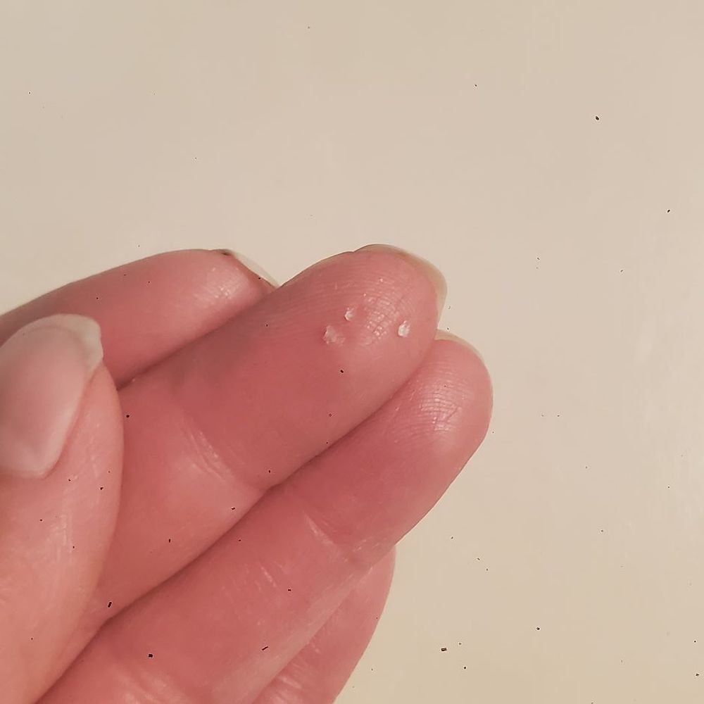 The Pho - Three pieces of glass/sand on my middle finger that i wiped from my tongue while eating the chicken pho. - Vietnamese Near Me - Manteca, California The Pho - Three pieces of glass/sand on my middle finger that i wiped from my tongue while eating the chicken pho. - Vietnamese Near Me - Manteca, California