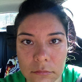 The Aesthetics Corner - After the needling with a chemical peel. Some swelling and redness. Good considering the high frequency poking with 36g needles - Skin Care Near Me - Folsom, California The Aesthetics Corner - After the needling with a chemical peel. Some swelling and redness. Good considering the high frequency poking with 36g needles - Skin Care Near Me - Folsom, California