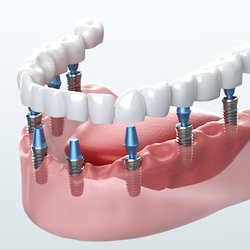 Boulevard Dental Group