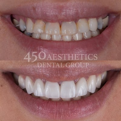 25+ Gorgeous 450 Aesthetics Dental Group Pictures