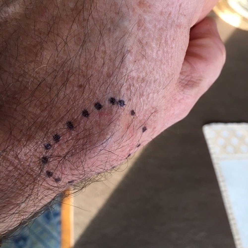 Lotus Wellness Center - These photos show the swelling bone joint caused by Dr Mala's treatment - Chiropractors Near Me - Orange, California Lotus Wellness Center - These photos show the swelling bone joint caused by Dr Mala's treatment - Chiropractors Near Me - Orange, California