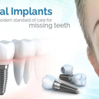 Vance Dentistry - Implant Service Vance Dentistry - General Dentistry Near Me - Milford, Ohio Vance Dentistry - Implant Service Vance Dentistry - General Dentistry Near Me - Milford, Ohio