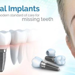 Vance Dentistry - Implant Service Vance Dentistry