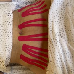 InnerGreat - Scar taping after full-body MLD treatment.