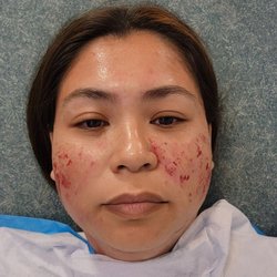Hawaii Integrative Healthcare - Treatment finished