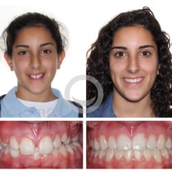 Waldman Orthodontics - February 2016 Smile of the Month