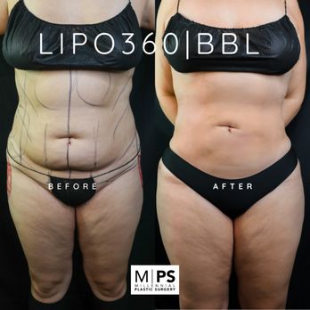 Millennial Plastic Surgery - Plastic Surgeons Near Me - New York, New York