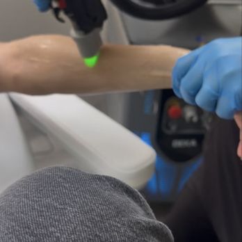 FMD Aesthetics - Latest-generation Alexandrite laser hair removal treatment. - Laser Hair Removal Near Me - Glendale, California FMD Aesthetics - Latest-generation Alexandrite laser hair removal treatment. - Laser Hair Removal Near Me - Glendale, California