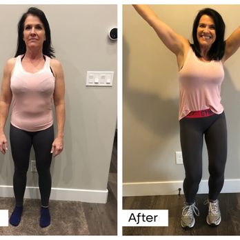 BelleSculpt - Body Contouring Near Me - Pleasant Grove, Utah