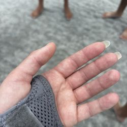 Advanced Urgent Care - skin discoloration