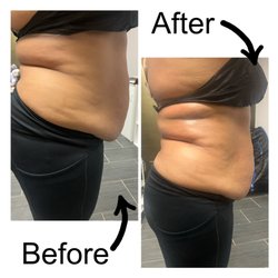 Karmic Kurves Body Sculpting