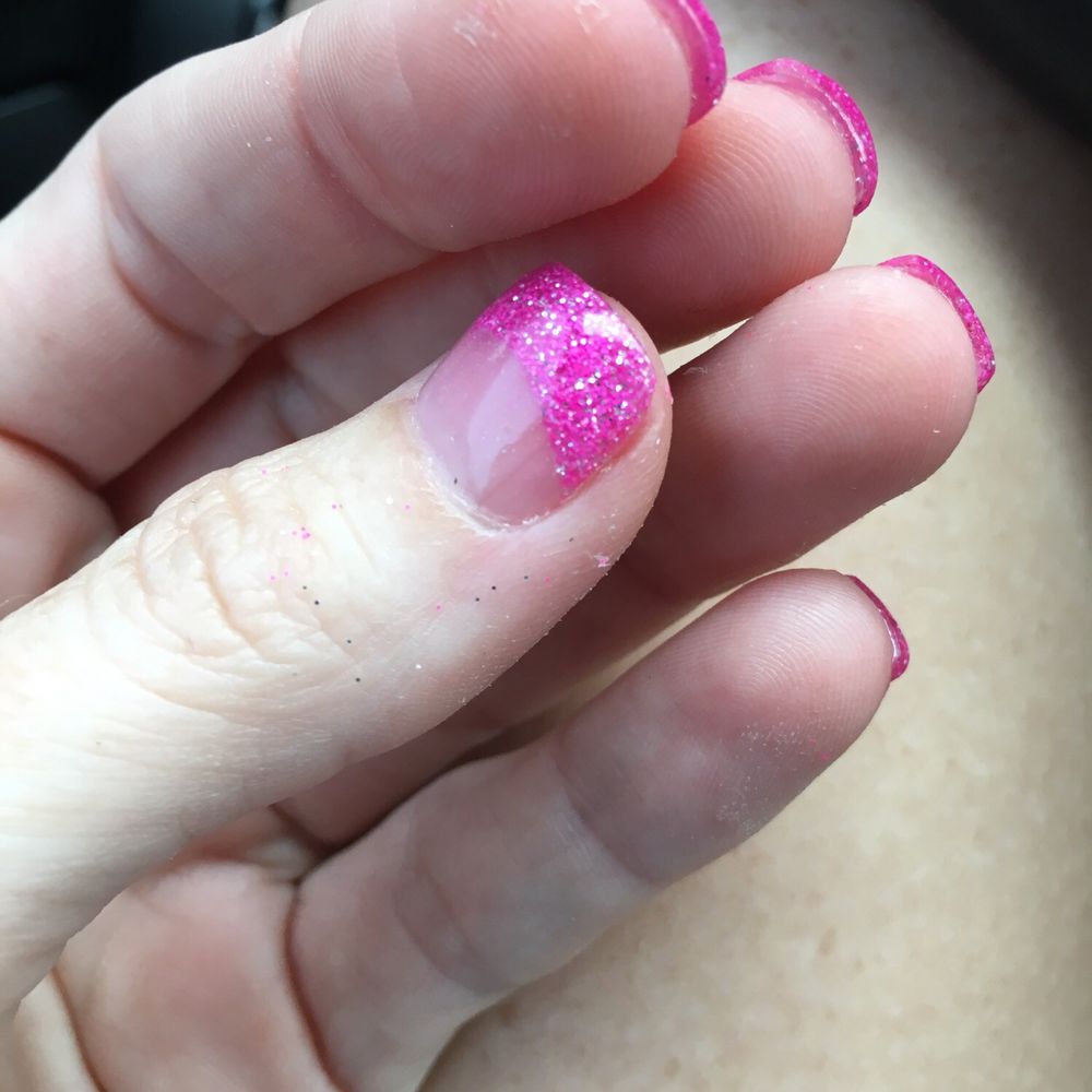 Zen Nails & Spa - Glitter on skin. Dried out skin from soaking. - Nail Salons Near Me - Palm Harbor, Florida