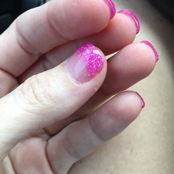 Zen Nails & Spa - Glitter on skin. Dried out skin from soaking. - Nail Salons Near Me - Palm Harbor, Florida Zen Nails & Spa - Glitter on skin. Dried out skin from soaking. - Nail Salons Near Me - Palm Harbor, Florida