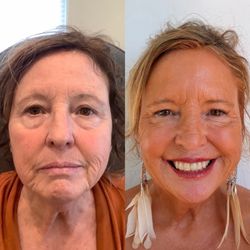 Rejuvenate Medi-Spa & Wellness