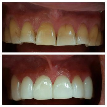 Lotus Dental Practice - General Dentistry Near Me - Ventura, California Lotus Dental Practice - General Dentistry Near Me - Ventura, California