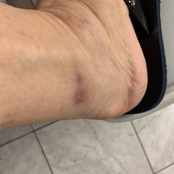 Gold Coast Dermatology Center 15 Photos 20 Reviews Dermatologists 4600 Linton Blvd Delray Beach Fl Phone Number